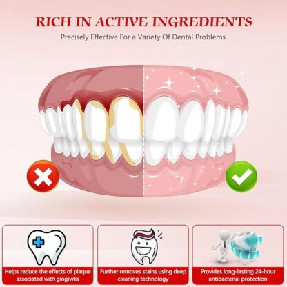 SP-6 Ultra probiotic whitening Toothpaste. - Image 4