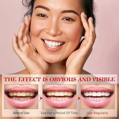 SP-6 Ultra probiotic whitening Toothpaste. - Image 5
